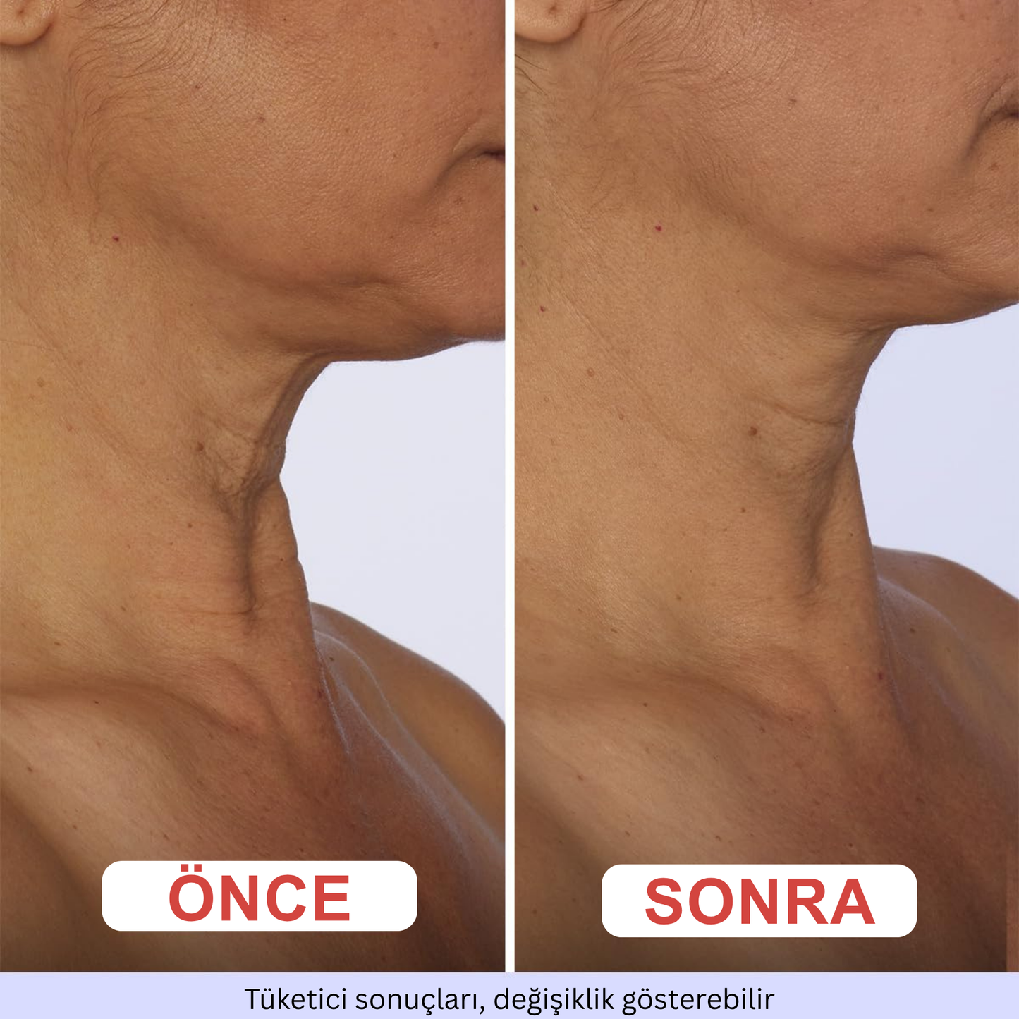 Viya Glow™ Boyun Sıkılaştırıcı ve Gerginleştirici Krem