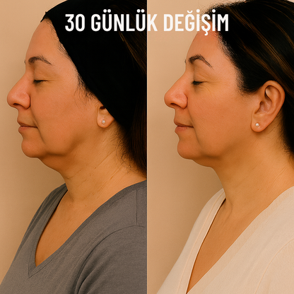 Viya Glow™ Yüz Şekillendirici ve V-Line Sıkılaştırma
