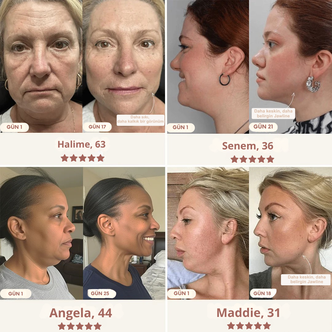 Viya Glow™ Yüz Şekillendirici ve V-Line Sıkılaştırma